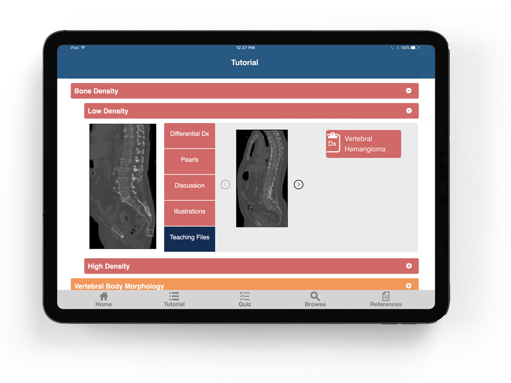 ctisus l-spine pathology app's old tutorial page on an ipad with Differential diagnosis, pearls, and discussion scans